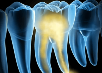 Невозможные, но реальные технологии: выращивание зубов